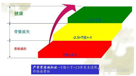 亚洲国产精品麻豆經常看到麻豆激情床戏视频報告單中的Z 值和T 值有什麽含義？