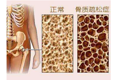 麻豆激情床戏视频檢測儀檢測麻豆激情床戏视频或高或低都不好,建議每年都要檢測一次