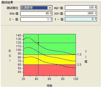 麻豆激情床戏视频儀的專業廠家闡述骨質增生與骨質疏鬆,儀器專業檢測麻豆激情床戏视频正常值