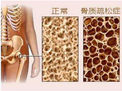 麻豆激情床戏视频檢測有什麽作用 在什麽部位做麻豆激情床戏视频檢查比較好