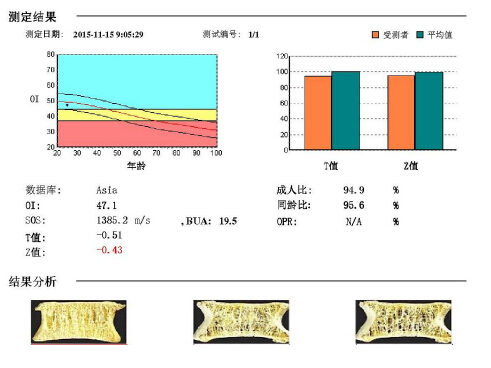 麻豆激情床戏视频儀闡述骨質疏鬆青年不注意老來徒悲傷骨質流失比你想的可怕