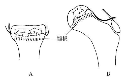 麻豆激情床戏视频測試儀生產廠家骨骺生長停止後還能修複嗎？