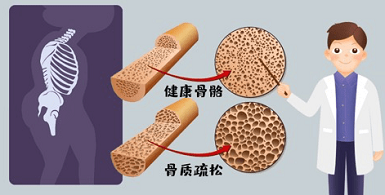 別大意！國產麻豆激情床戏视频儀生產廠家老人跌倒比想象中的危險麻豆激情床戏视频影響很大