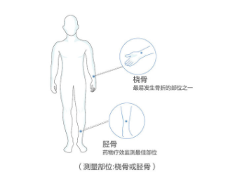 超聲麻豆激情床戏视频儀價格橈骨測麻豆激情床戏视频的準確率高嗎