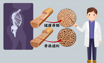 超聲便捷式麻豆激情床戏视频儀品牌如同人容貌衰老一樣身體骨骼不保養一樣衰老