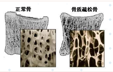 隨著年齡的增長，你變矮了嗎?超聲波麻豆激情床戏视频儀的廠家已經揭示了他們的秘密